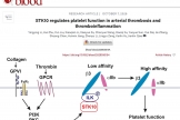 我院血液科在Blood杂志发表最新研究成果